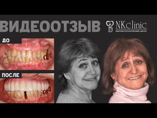 Удалили опухоль и восстановили челюсть. Отзыв пациента о микрохирургической операции