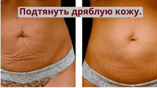 Зрелая кожа: сухость, дряблость и растяжки. Домашнее средство для омоложения кожи тела.