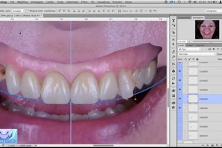 ADSD Aesthetic Digital Smile Design - Dal ritratto del paziente al Digital Dental Image Editing
