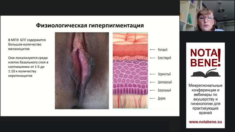 Заболевания вульвы в практике акушера гинеколога Бебнева