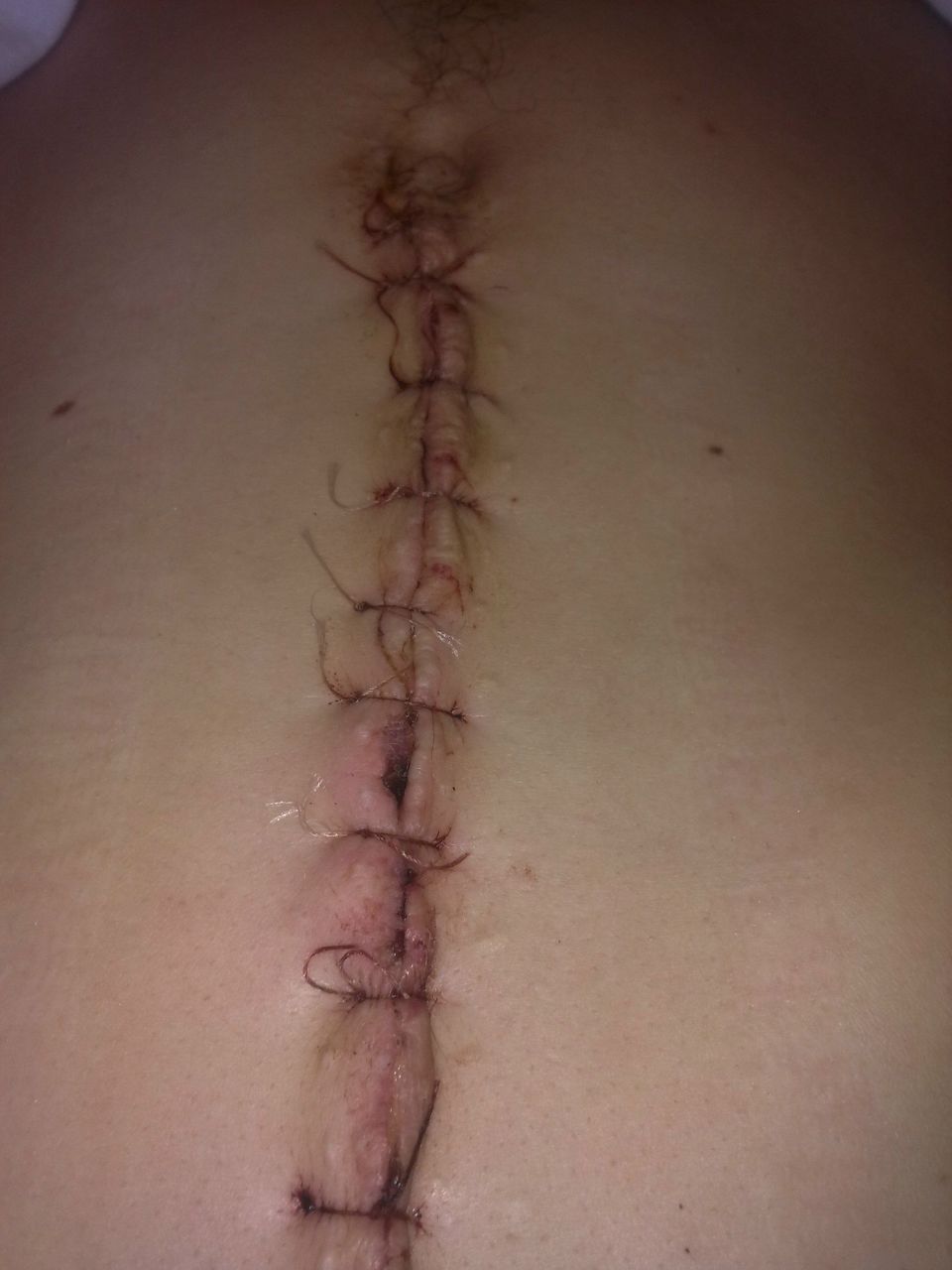 Толян Хмелевский | Санкт-Петербург