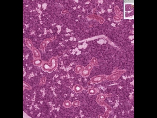 submandibular