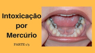 Intoxicação Por Mercúrio ► Parte 1/3