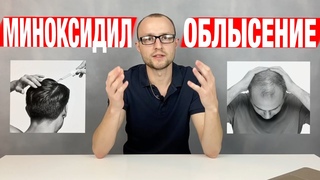 Облысение у мужчин. Лечение / Миноксидил для бороды и волос / Выпадают волосы что делать
