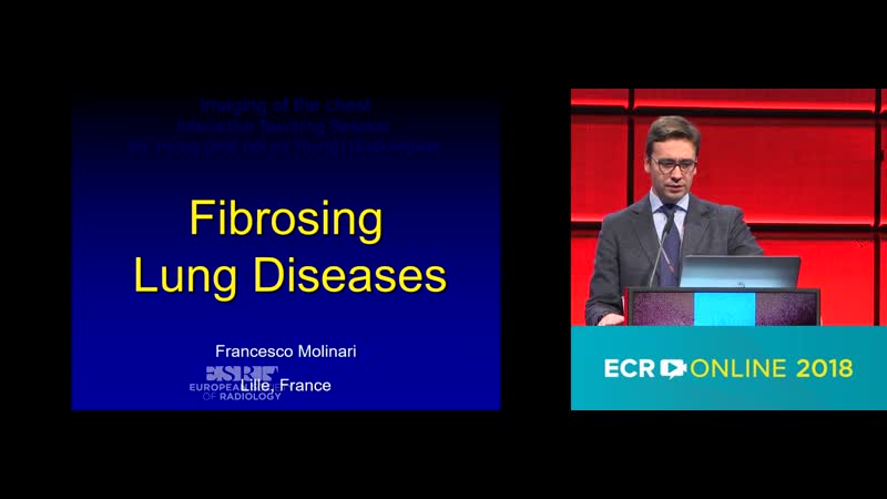 Fibrosing lung diseases F.