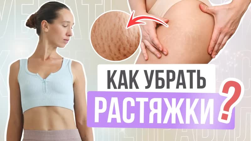 КАК УБРАТЬ РАСТЯЖКИ НА ТЕЛЕ Всё что нужно знать о растяжках
